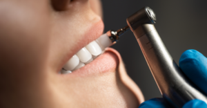 Dental Cleaning - Emergency Dental of Las Vegas